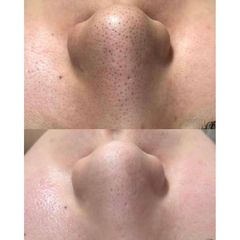 before-after