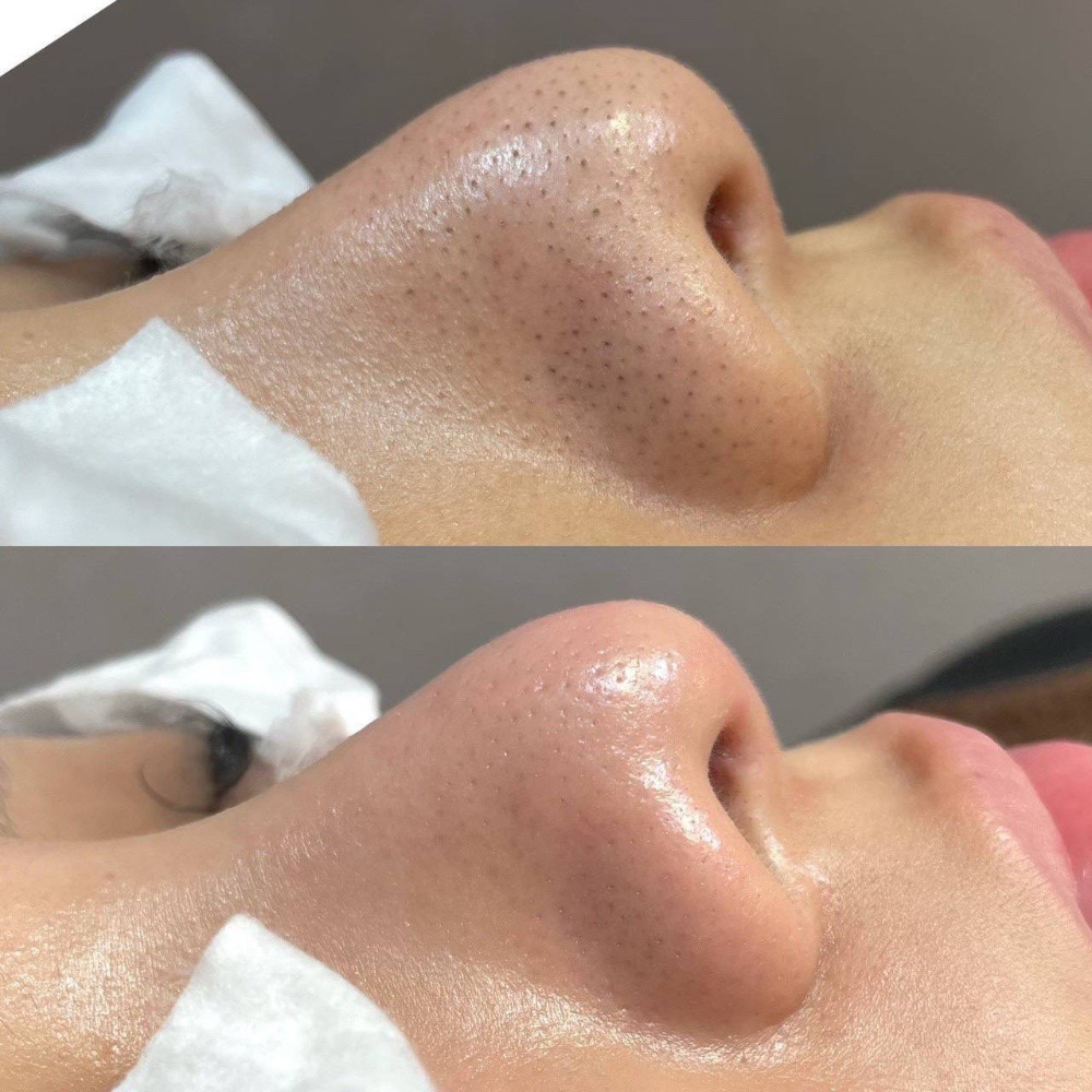 before-after